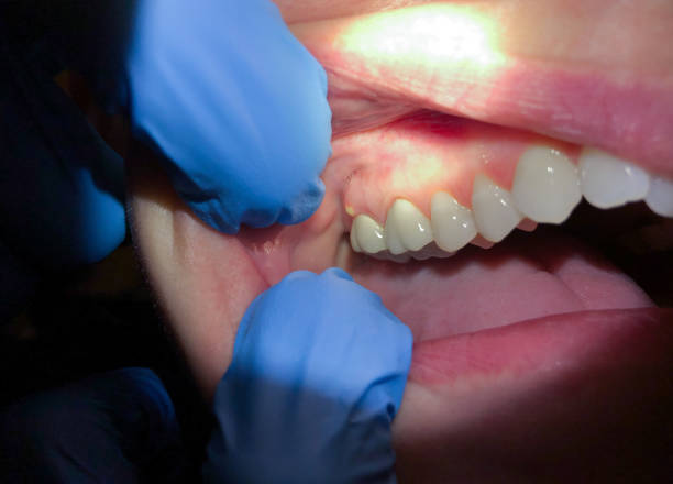 Best Emergency Dental Care for Trauma or Injury in Richlands, VA