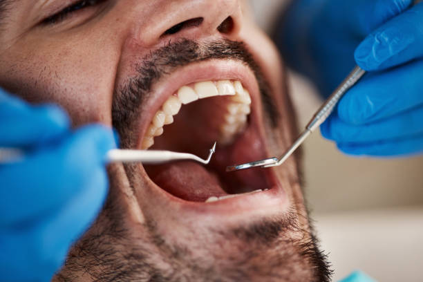 Best Emergency Treatment for Toothache in Richlands, VA